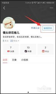 更换头条名字好吗吗,名字更迭，开启全新篇章